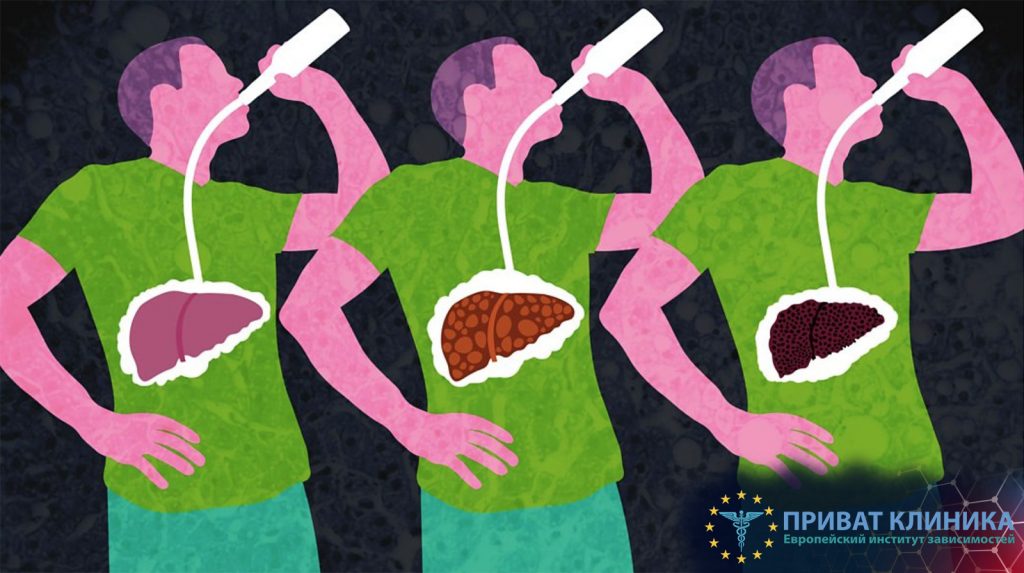 Симптоми запою