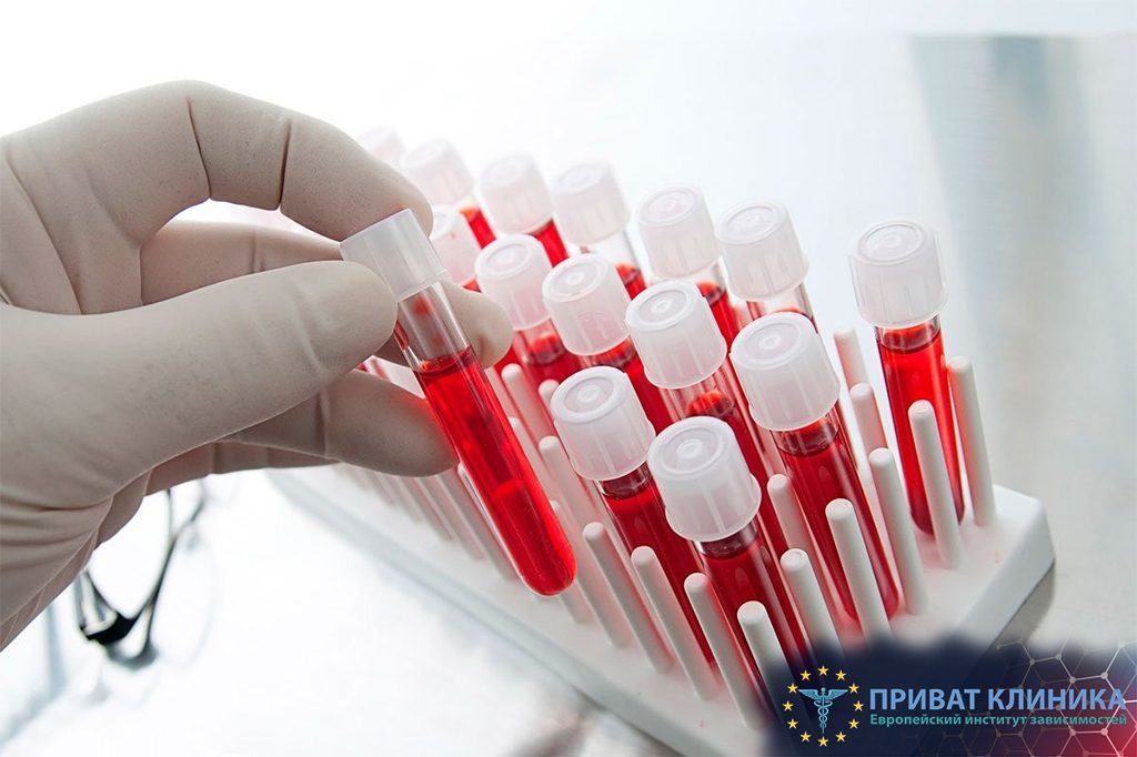 Швидке лікування наркоманії